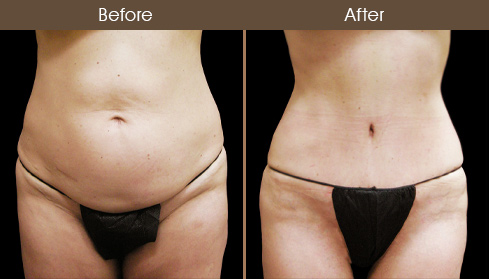 20202705152016_B15-Front